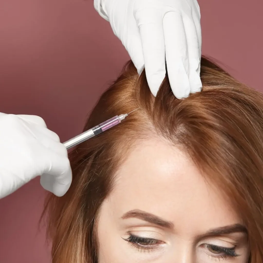 PRP Hair Injections
