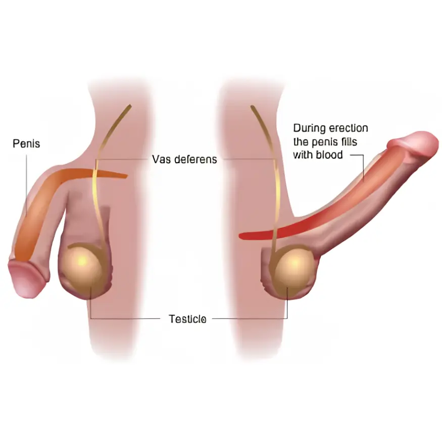 Treatment for Erectile dysfunction