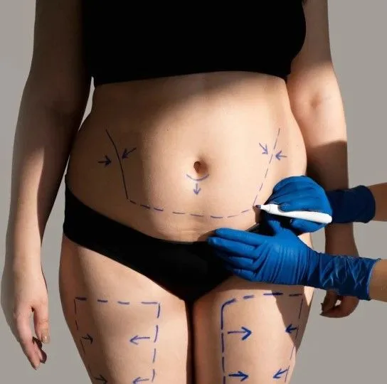 body contouring CLAGS