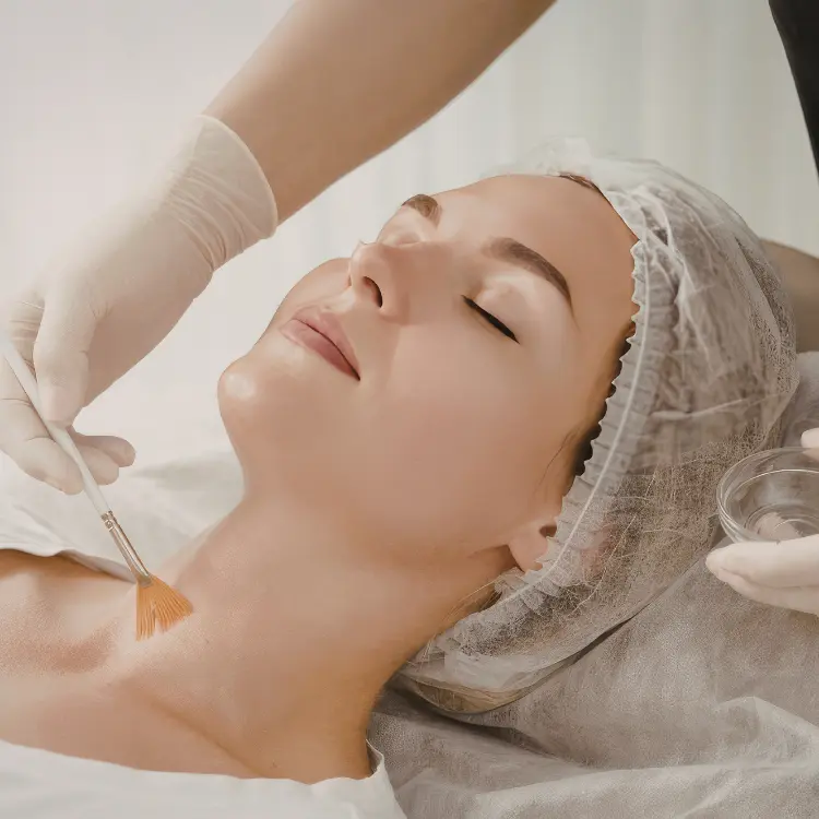 Chemical peels treatment showing skin exfoliation and facial rejuvenation procedure