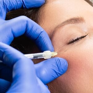 derma fillers
