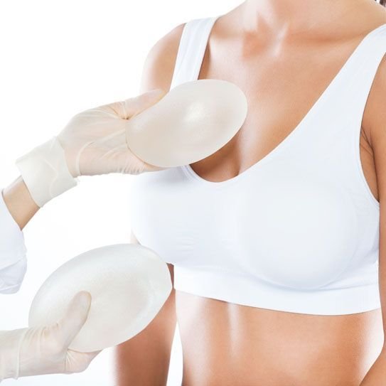 Breast implants showing augmentation mammoplasty and cosmetic breast enhancement