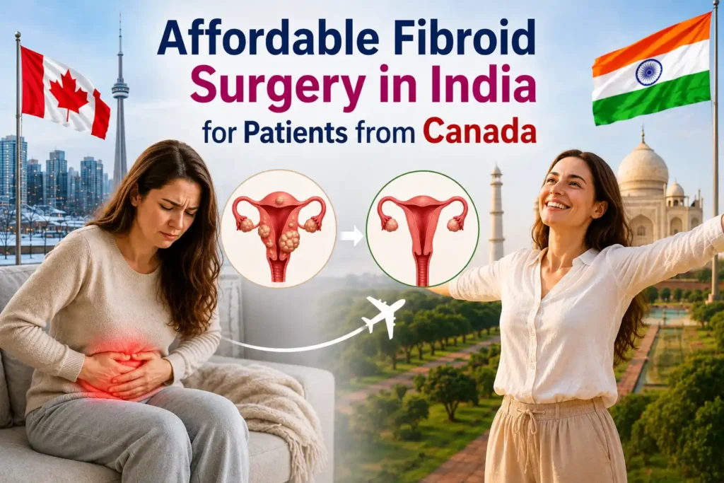 Affordable Fibroid Surgery in India for Canadian Patients